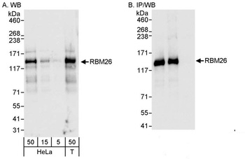Rabbit anti-RBM26 Antibody