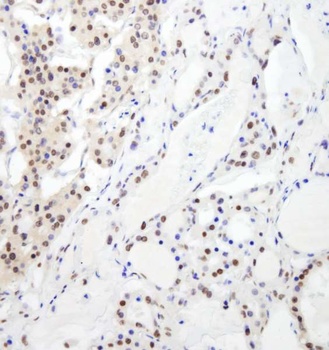Rabbit anti-RBM26 Antibody