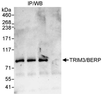 TRIM3/BERP Antibody