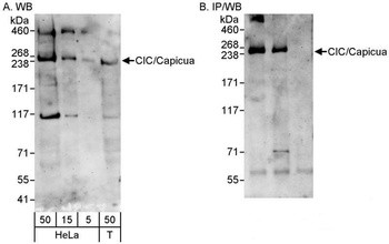 Rabbit anti-CIC/Capicua Antibody