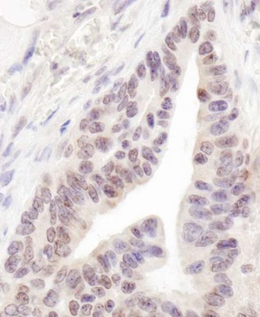 Rabbit anti-RBM12 Antibody