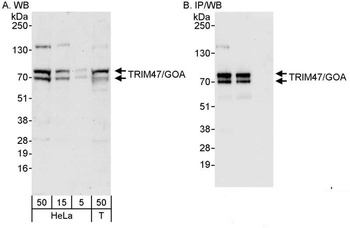 TRIM47/GOA Antibody