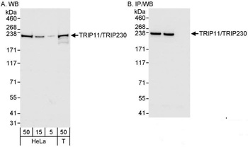 Rabbit anti-TRIP11/TRIP230 Antibody