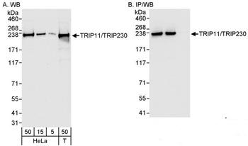 Rabbit anti-TRIP11/TRIP230 Antibody