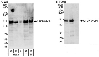 CTDP1/FCP1 Antibody