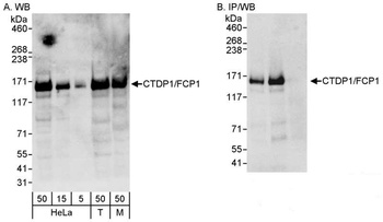 Rabbit anti-CTDP1/FCP1 Antibody
