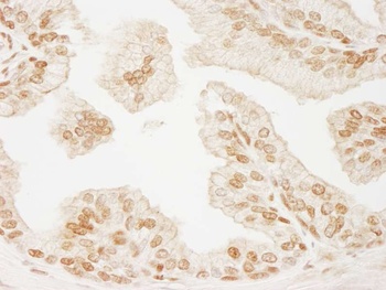 Rabbit anti-PML Antibody