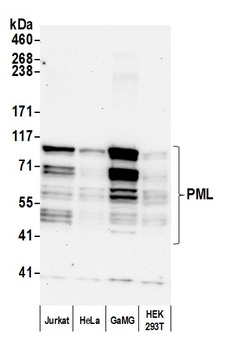 Rabbit anti-PML Antibody