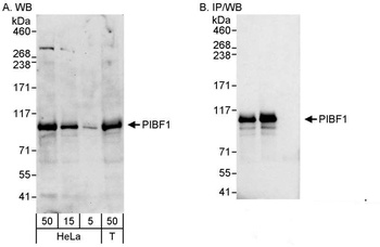Rabbit anti-PIBF Antibody
