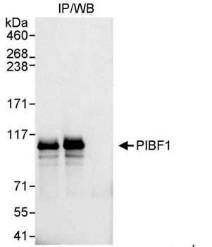 Rabbit anti-PIBF Antibody