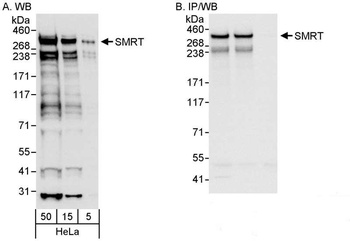 Rabbit anti-SMRT Antibody