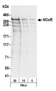Rabbit anti-NCoR Antibody