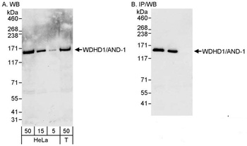 WDHD1/AND-1 Antibody