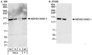Rabbit anti-WDHD1/AND-1 Antibody