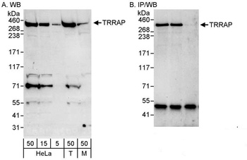 Rabbit anti-TRRAP Antibody