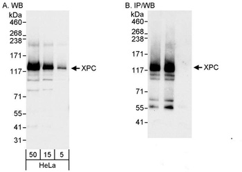 Rabbit anti-XPC Antibody