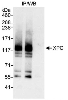 Rabbit anti-XPC Antibody