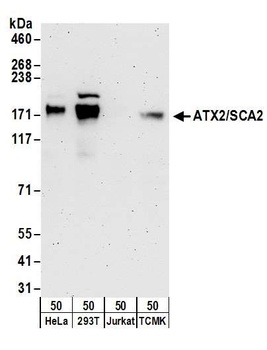 ATX2/SCA2 Antibody