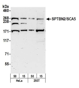 SPTBN2/SCA5 Antibody