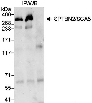 Rabbit anti-SPTBN2/SCA5 Antibody