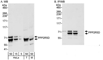 PPP2R5D Antibody