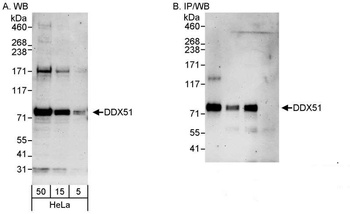 Rabbit anti-DDX51 Antibody