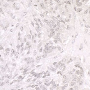 Rabbit anti-SMARCA1/SNF2L Antibody