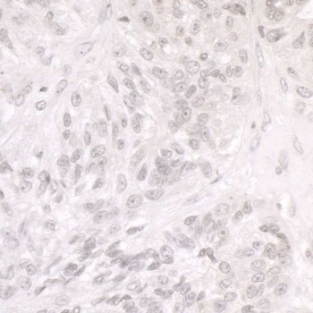 SMARCA1/SNF2L Antibody