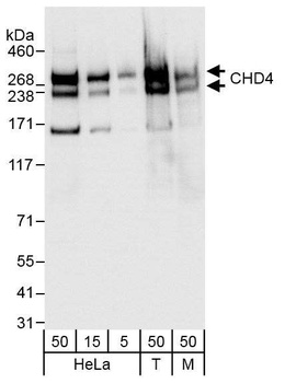 Rabbit anti-CHD4 Antibody