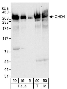 Rabbit anti-CHD4 Antibody