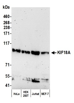 KIF18A Antibody