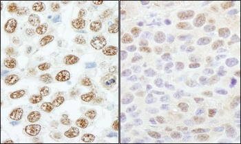 Rabbit anti-RBM25/RED120 Antibody