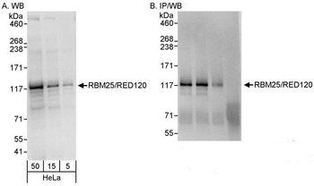 Rabbit anti-RBM25/RED120 Antibody