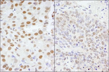 Rabbit anti-AKAP8/AKAP95 Antibody