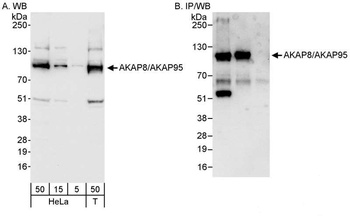 Rabbit anti-AKAP8/AKAP95 Antibody