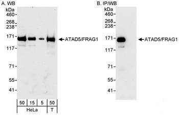 Rabbit anti-ATAD5/FRAG1 Antibody
