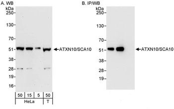 ATXN10/SCA10 Antibody