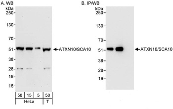 Rabbit anti-ATXN10/SCA10 Antibody