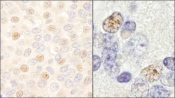 Rabbit anti-DDX46 Antibody