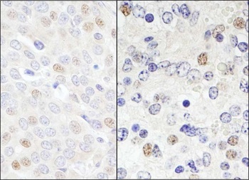Rabbit anti-DDX46 Antibody