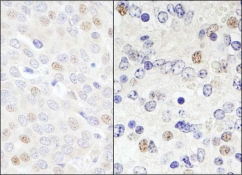 DDX46 Antibody