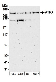 ATRX Antibody