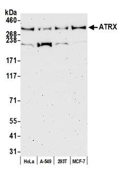 Rabbit anti-ATRX Antibody