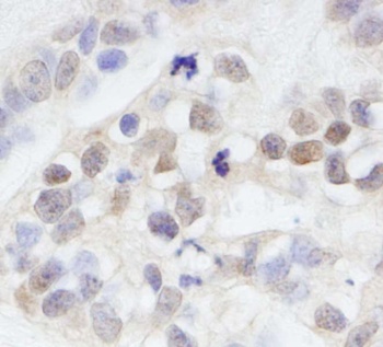 Rabbit anti-MAGED2 Antibody