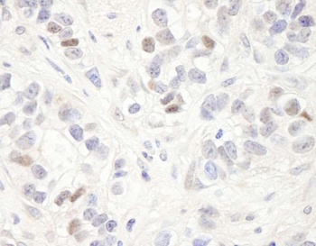 Rabbit anti-MAGED2 Antibody