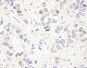 MAGED2 Antibody