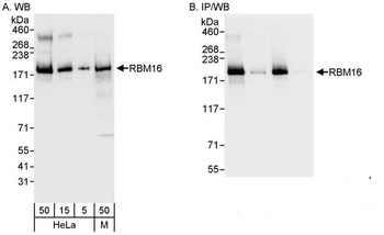 Rabbit anti-RBM16 Antibody