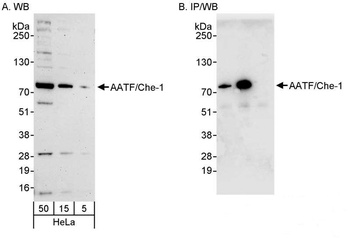 AATF/Che-1 Antibody