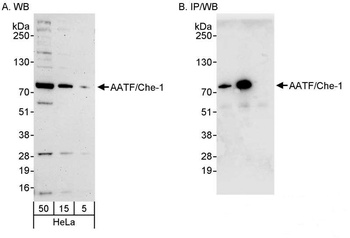 Rabbit anti-AATF/Che-1 Antibody