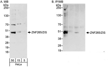 ZNF265/ZIS Antibody